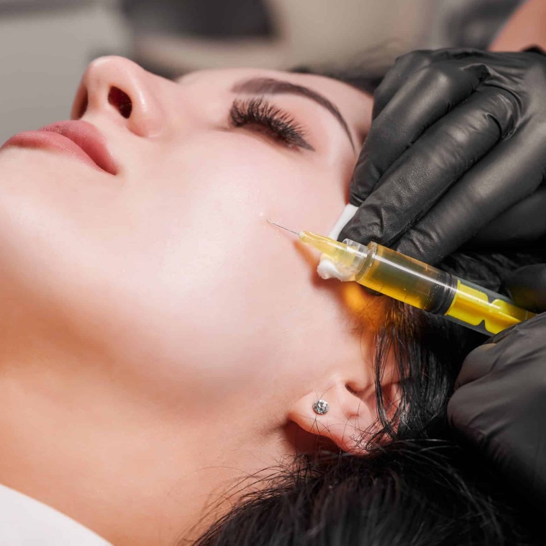 Female doctor making injection in woman chin. Close-up of plasmolifting procedure injection. Doctor cosmetologist beautician in black sterile gloves making injection in female patient face. Concept of skincare treatment.